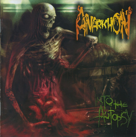 Anarkhon - Into The Autopsy