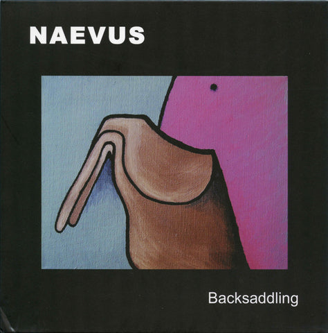 Naevus - Backsaddling